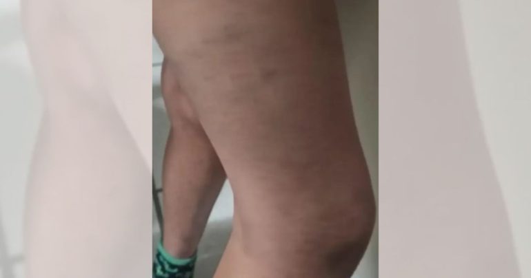 Tortura de irmãos em Santa Catarina expõe rotina de violência dentro de casa