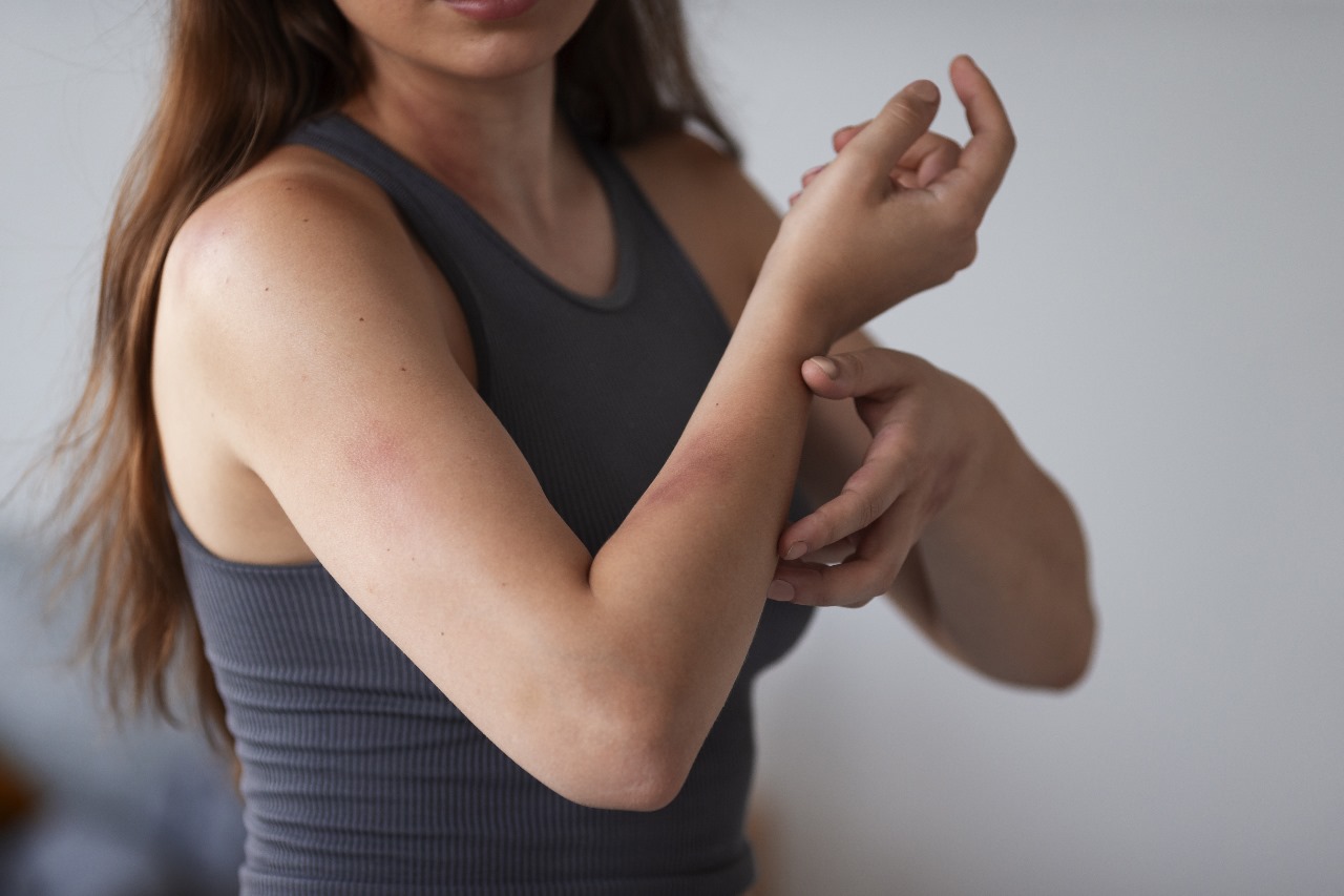 Alergia à borracha? Entenda o que é a dermatite de contato e como lidar com ela